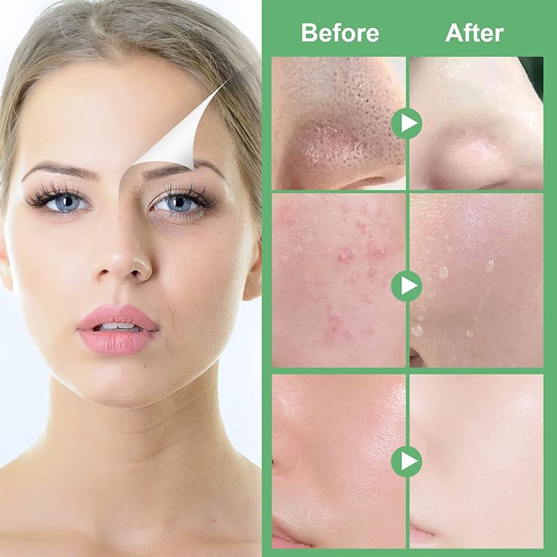 Green Tea Mask Stick - Remove blackheads with green tea extract - | Fashiongirl